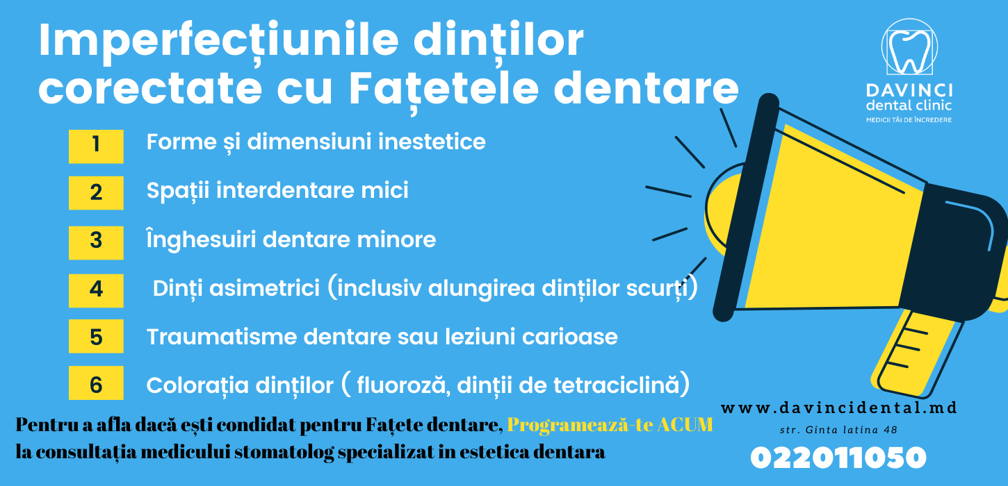 ce defecte, probleme dentare rezolva fatetele dentare